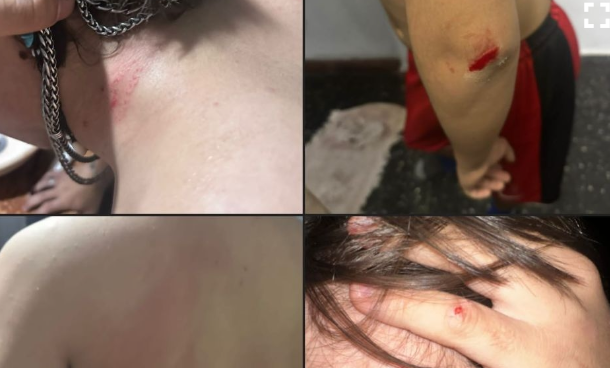 Amenazó y golpeó a un niño de 15 años tras una pelea de perros