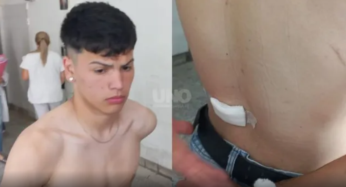 Axel Segovia, el joven baleado en la costanera santafesina: “Sentimos dos impactos y salimos de ahí como pudimos”