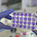 CONICET: hallan un mecanismo común de replicación en el dengue, Zika y fiebre amarilla