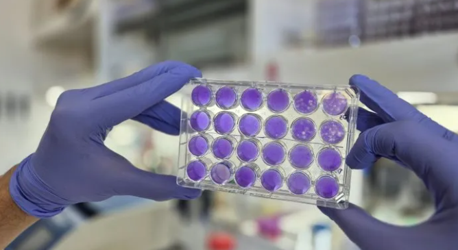 CONICET: hallan un mecanismo común de replicación en el dengue, Zika y fiebre amarilla